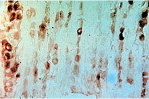 Immunohistochemical staining of rat dorsal root ganglia using rabbit Gfra3 polyclonal antibody  . (GFRA3 Antikörper  (AA 1-11))