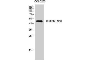 Western Blotting (WB) image for anti-B-Cell Linker (BLNK) (pTyr96) antibody (ABIN3182572) (B-Cell Linker Antikörper  (pTyr96))