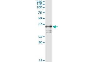 Immunoprecipitation of TOMM34 transfected lysate using anti-TOMM34 monoclonal antibody and Protein A Magnetic Bead , and immunoblotted with TOMM34 MaxPab rabbit polyclonal antibody. (TOMM34 Antikörper  (AA 1-309))