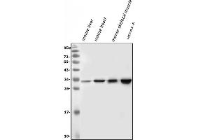 Western blot analysis of VAPB using anti-VAPB antibody (ABIN5693292). (VAPB Antikörper  (AA 2-55))