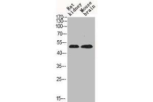 Western Blot analysis of RAT-KIDNEY mouse-brain cells using Phospho-JNK1/2/3 (T183) Polyclonal Antibody (MAPK8/MAPK9/MAPK1 (pThr183) Antikörper)