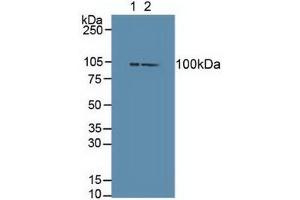 Western blot analysis of (1) Mouse Brain Tissue and (2) Mouse Liver Tissue. (DVL3 Antikörper  (AA 545-716))