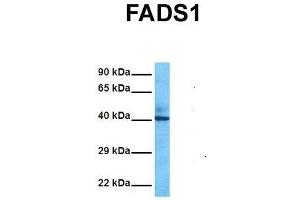 Host:  Rabbit  Target Name:  FADS1  Sample Tissue:  Human Fetal Liver  Antibody Dilution:  1. (FADS1 Antikörper  (C-Term))
