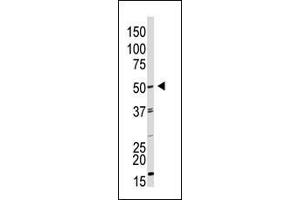 The anti-GDF9 N-term Pab (ABIN388822 and ABIN2839140) is used in Western blot to detect GDF9 in HL60 cell lysate. (GDF9 Antikörper  (N-Term))