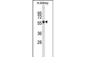 Western blot analysis of Park6 (PINK1) C-term (ABIN652208 and ABIN2840776) in mouse kidney tissue lysates (35 μg/lane). (PINK1 Antikörper  (C-Term))