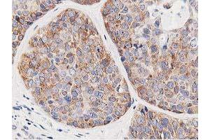 Immunohistochemistry (IHC) image for anti-Leucine Carboxyl Methyltransferase 1 (LCMT1) antibody (ABIN1499107) (LCMT1 Antikörper)