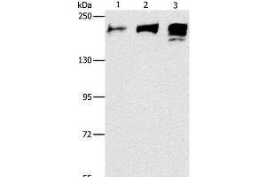 Western Blot analysis of Human ileum adenocarcinoma tissue, Human testis and prostate tissue using ACE1 Polyclonal Antibody at dilution of 1:240 (Angiotensin I Converting Enzyme 1 Antikörper)
