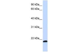 Western Blotting (WB) image for anti-Chromosome 21 Open Reading Frame 56 (C21orf56) antibody (ABIN2458971) (C21ORF56 Antikörper)