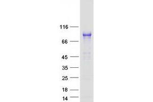 Validation with Western Blot