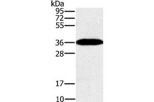 Western Blot analysis of Mouse brain tissue using PPP1CC Polyclonal Antibody at dilution of 1:200 (PPP1CC Antikörper)