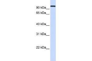 WB Suggested Anti-HSPA4 Antibody Titration: 0. (HSPA4 Antikörper  (Middle Region))