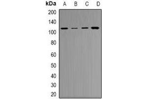 Western blot analysis of RB1 expression in A549 (A), NIH3T3 (B), K562 (C), PC12 (D) whole cell lysates. (Retinoblastoma 1 Antikörper)
