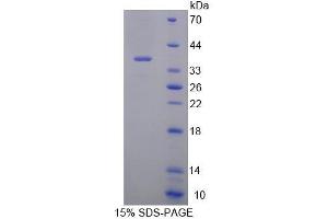 SDS-PAGE analysis of Mouse RGN Protein. (Regucalcin Protein (RGN))