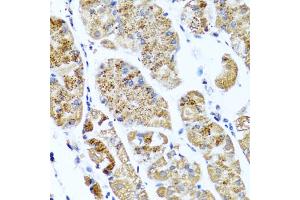 Immunohistochemistry of paraffin-embedded human stomach using COL10A1 antibody (ABIN5974149) at dilution of 1/100 (40x lens). (COL10A1 Antikörper)