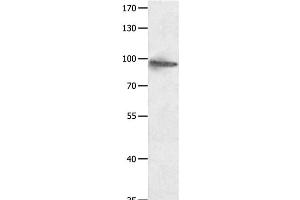 Western Blot analysis of Hela cell using HCN1 Polyclonal Antibody at dilution of 1:950 (HCN1 Antikörper)