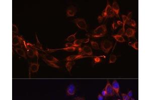 Immunofluorescence analysis of NIH-3T3 cells using DKK3 Polyclonal Antibody at dilution of 1:100 (40x lens). (DKK3 Antikörper)