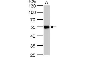 WB Image beta Tubulin 2 antibody detects beta Tubulin 2 protein by western blot analysis. (TUBB2A Antikörper)