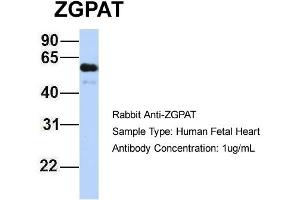 Host: Rabbit Target Name: ZGPAT Sample Type: Human Fetal Heart Antibody Dilution: 1.