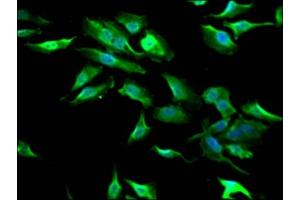 Immunofluorescence staining of Hela Cells with  at 1:50, counter-stained with DAPI.