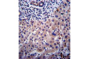 CYP3A4 Antibody (Center) ABIN392216 immunohistochemistry analysis in formalin fixed and paraffin embedded human liver tissue followed by peroxidase conjugation of the secondary antibody and DAB staining. (CYP3A4 Antikörper  (AA 228-255))