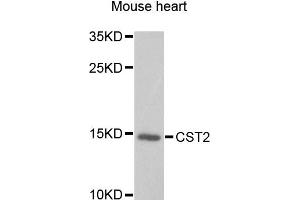 Western blot analysis of extracts of mouse heart, using CST2 antibody. (CST2 Antikörper)