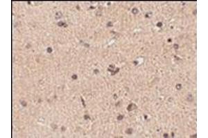 Immunohistochemistry of Slitrk2 in human brain tissue with this product at 2.