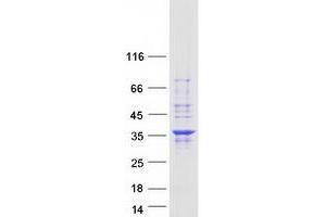Western Blotting (WB) image for Partner of NOB1 Homolog (PNO1) protein (Myc-DYKDDDDK Tag) (ABIN2729261)