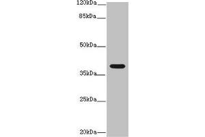 Western blot All lanes: Interleukin-12 subunit beta antibody at 14 μg/mL + K562 whole cell lysate Secondary Goat polyclonal to rabbit IgG at 1/10000 dilution Predicted band size: 37 kDa Observed band size: 37 kDa (IL12B Antikörper  (AA 23-327))