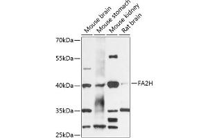 Western blot analysis of extracts of various cell lines, using FH antibody (ABIN6130395, ABIN6140411, ABIN6140413 and ABIN6218027) at 1:3000 dilution. (FA2H Antikörper  (AA 95-170))