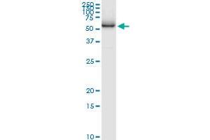 Immunoprecipitation (IP) image for anti-ATPase, H+ Transporting, Lysosomal 50/57kDa, V1 Subunit H (ATP6V1H) (AA 1-483) antibody (ABIN949344)