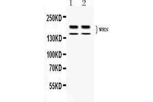 Western blot analysis of WRN expression in rat thymus extract ( Lane 1) and human placenta extract ( Lane 2).