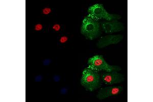 CIP29 Antibody staining Hela cells by IF/ICC.