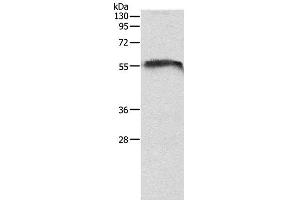 Western Blot analysis of Mouse brain tissue using Otocadherin Polyclonal Antibody at dilution of 1:1050 (CDH23 Antikörper)