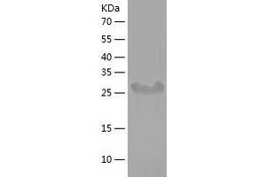 Western Blotting (WB) image for Signal Transducing Adaptor Family Member 1 (STAP1) (AA 1-295) protein (His tag) (ABIN7289386) (STAP1 Protein (AA 1-295) (His tag))