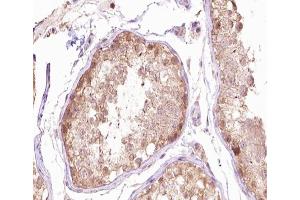 ABIN6266666 at 1/100 staining human testis tissue sections by IHC-P. (TUBG1 Antikörper  (N-Term))