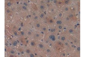 Immunohistochemistry (IHC) image for anti-Leukocyte Immunoglobulin-Like Receptor, Subfamily B (With TM and ITIM Domains), Member 2 (LILRB2) (AA 53-255) antibody (ABIN7444112)