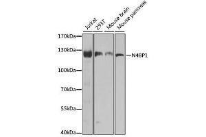 Western blot analysis of extracts of various cell lines, using N4BP1 antibody. (N4BP1 Antikörper  (AA 190-590))