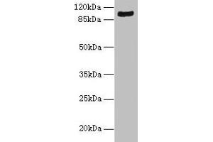 Western blot All lanes: TMTC1 antibody at 6 μg/mL + Mouse large intestine tissue Secondary Goat polyclonal to rabbit IgG at 1/10000 dilution Predicted band size: 99, 88, 74, 66, 26 kDa Observed band size: 99 kDa (TMTC1 Antikörper  (AA 1-227))
