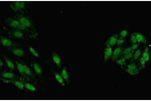 Immunofluorescent analysis of HepG2 cells using ABIN7154122 at dilution of 1:100 and Alexa Fluor 488-congugated AffiniPure Goat Anti-Rabbit IgG(H+L)