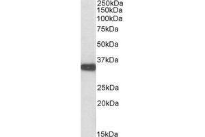 AP23666PU-N ASPA antibody staining of Mouse Kidney lysate at 0. (ASPA Antikörper  (C-Term))