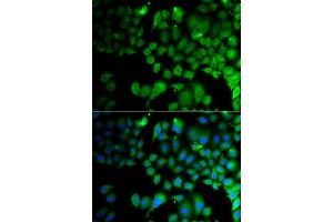 Immunofluorescence analysis of A549 cell using JMJD7 antibody. (JMJD7 Antikörper)