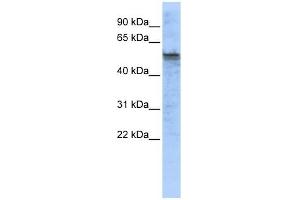 TPH2 antibody used at 1 ug/ml to detect target protein. (Tryptophan Hydroxylase 2 Antikörper  (Middle Region))