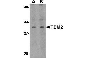 Western Blotting (WB) image for anti-RASD Family, Member 2 (RASD2) (C-Term) antibody (ABIN1030728) (RASD2 Antikörper  (C-Term))