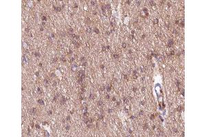 ABIN6266547 at 1/200 staining human brain tissue sections by IHC-P. (mGluR2/3 Antikörper)
