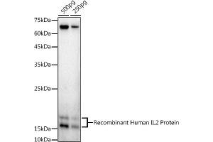 Western blot analysis of extracts of Recombinant Human IL2 Protein, using IL2 antibody (ABIN3020908, ABIN3020909, ABIN3020910 and ABIN6213790) at 1:1000 dilution. (IL-2 Antikörper  (AA 21-153))