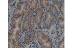 Used in DAB staining on fromalin fixed paraffin- embedded stomach tissue (Calpain 9 Antikörper  (AA 42-340))