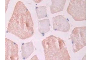 Detection of ENG in Rat Skeletal muscle Tissue using Polyclonal Antibody to Endoglin (ENG) (Endoglin Antikörper  (AA 26-136))