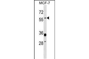 Western blot analysis in MCF-7 cell line lysates (35ug/lane). (ERVW-1 Antikörper  (C-Term))