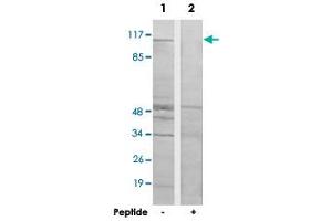 Western blot analysis of extracts from HT-29 cells, using KIAA1804 polyclonal antibody .
