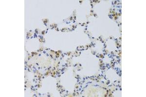 Immunohistochemistry of paraffin-embedded rat lung using HMGB1 Antibody. (HMGB1 Antikörper  (AA 100-200))
